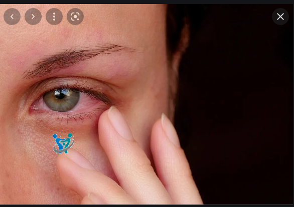 علامات الحمل من العين 8 علامات الحمل من العين